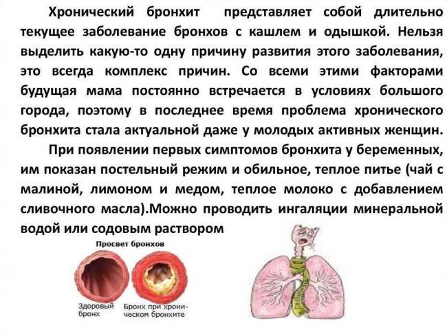 Бронхит при беременности 2 триместр