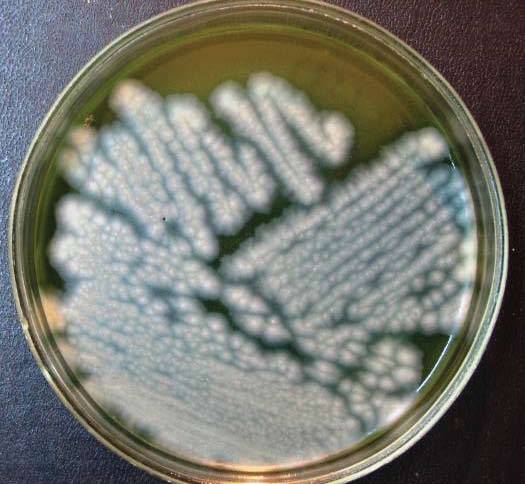 Bacillus cereus — wikipedia republished // wiki 2