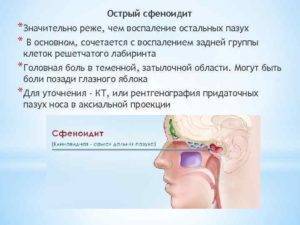 Сфеноидит. причины, симптомы, признаки, диагностика и лечение патологии