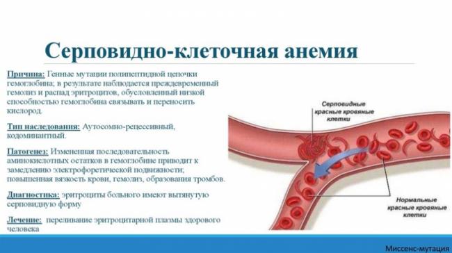 Анемия – что это такое, основные симптомы и лечение
