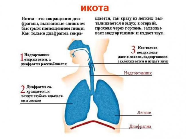 Как быстро избавиться от долгой икоты — способы, проверенные методы