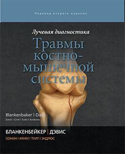 Спондилит позвоночника