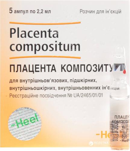 Дискус композитум при грыже позвоночника отзывы