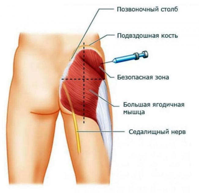 Актовегин (уколы \ таблетки)