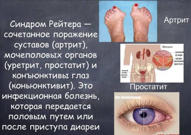 Красные точки на ладонях