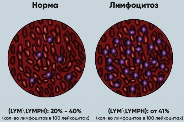 Лимфоциты