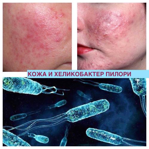 Какова норма содержания бактерий в организме здорового человека