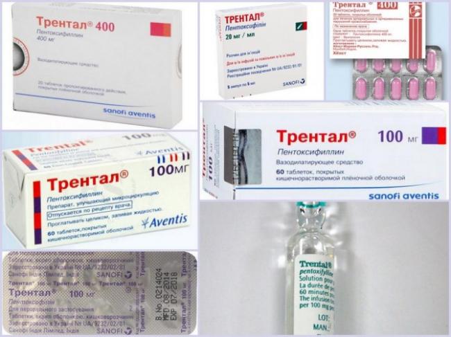 От чего помогают таблетки «трентал». инструкция по применению
