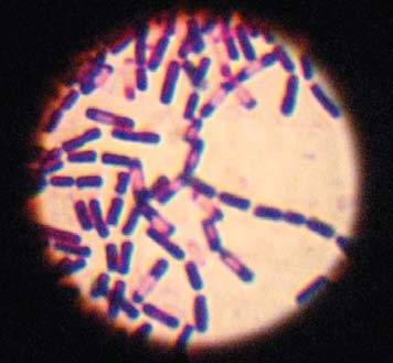 Bacillus thuringiensis