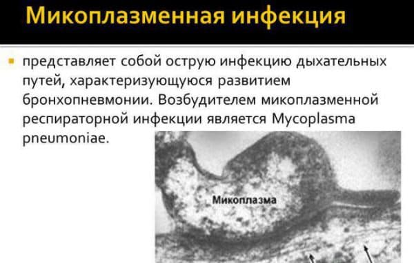 Заразна ли микоплазма пневмонии?