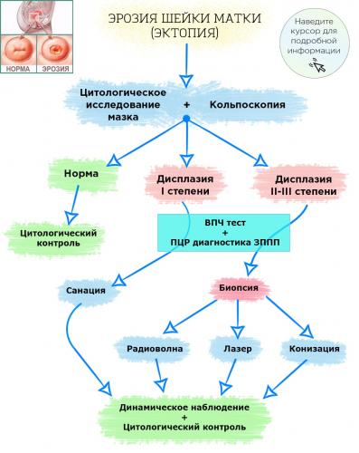 Лечение цервицита