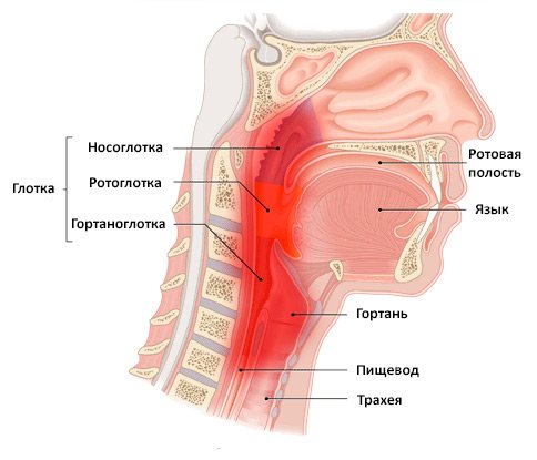 Как быстро вылечить фарингит хронический в домашних условиях