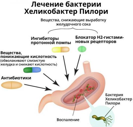 Повторный анализ на хеликобактер - вопрос гастроэнтерологу - 03 онлайн