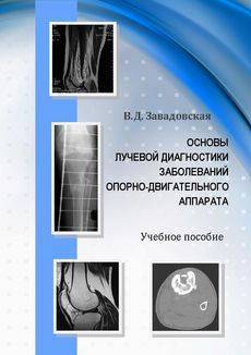 Туберкулезный спондилит позвоночника