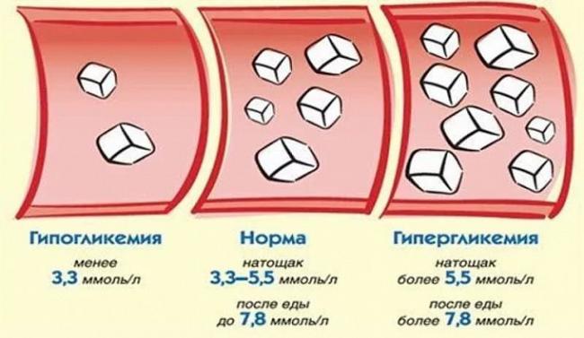 6 признаков гипогликемии