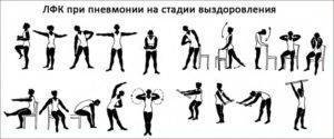 Дыхательная гимнастика при диагнозе «пневмония»