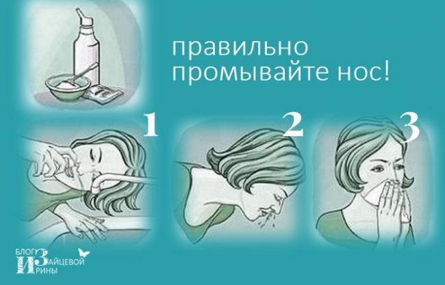 Чем промыть нос при гайморите в домашних условиях и как правильно это сделать
