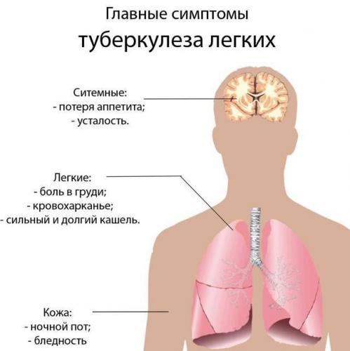 Как выявить туберкулез легких на ранних стадиях