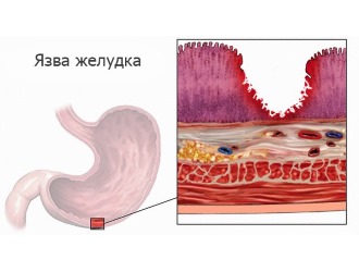 Фламидез