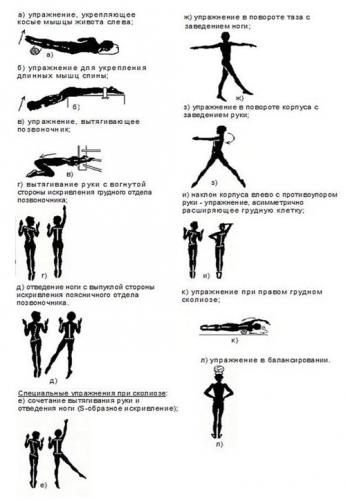 Лфк при кифозе грудного отдела позвоночника