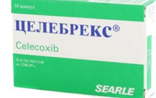 Остенил — эффективное средство при лечении болезней суставов