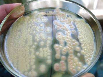 Bacillus cereus у детей - симптомы болезни, профилактика и лечение bacillus cereus у детей, причины заболевания и его диагностика на eurolab