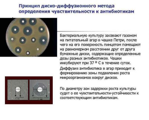 Анализ на чувствительность к бактериофагам, дисбактериоз кишечника. расшифровка