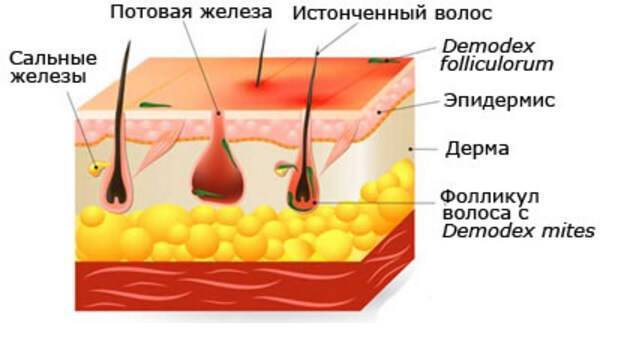 Мазь ЯМ БК. Можно ли с её помощью лечить прыщи