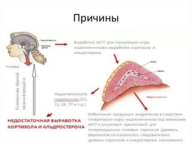 Адреногенитальный синдром