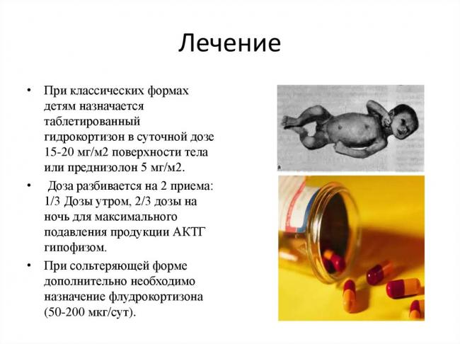 Адреногенитальный синдром - симптомы болезни, профилактика и лечение адреногенитального синдрома, причины заболевания и его диагностика на eurolab