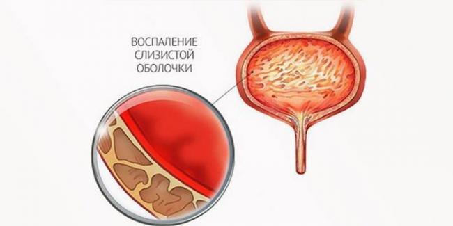 Таблетки таваник 500 от чего помогает. Таваник антибиотик инструкция по применению