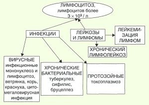 Лимфоцитоз