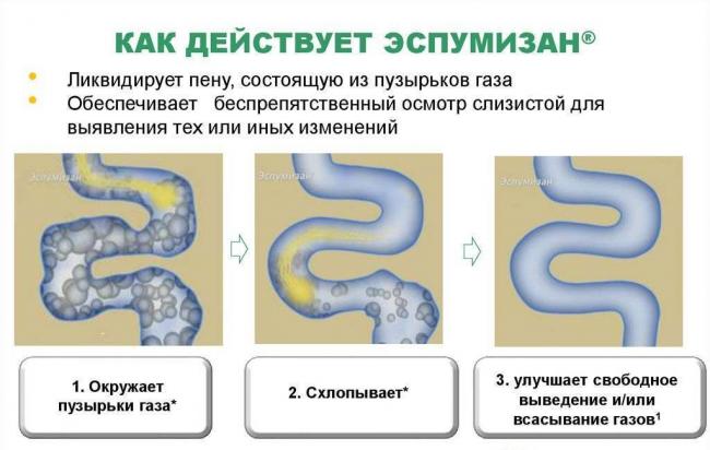Эспумизан - официальная инструкция по применению