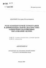 Туберкулома отличие от рака на снимке. как отличить туберкулез легких от рака, их сходства и различия