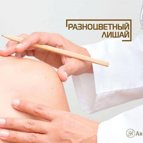 Влияние грибков рода malassezia на организм человека