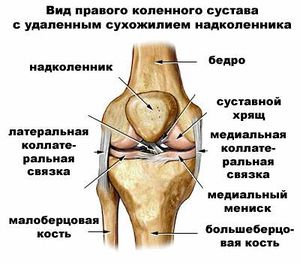 Растяжение связок коленного сустава сроки восстановления
