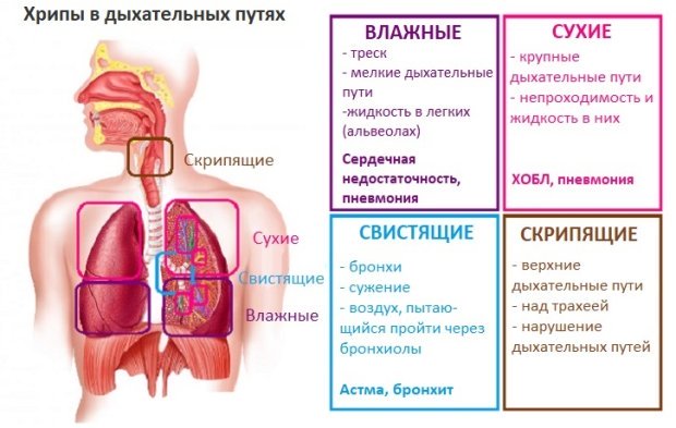 Бывает ли пневмония без температуры? пневмония без температуры и кашля