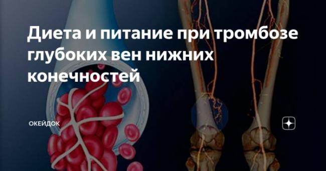 Диета (питание) при тромбозе глубоких вен (сосудов) нижних конечностей и какие продукты разжижают кровь