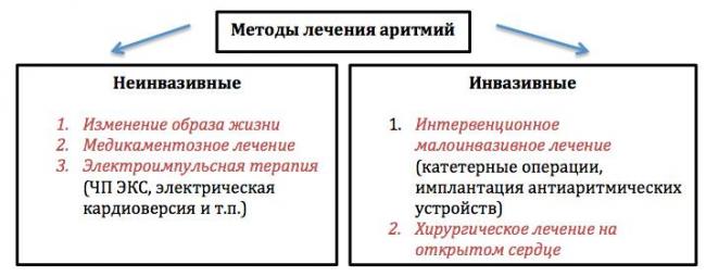 Аритмия