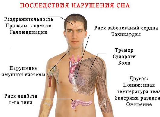 Сомнол