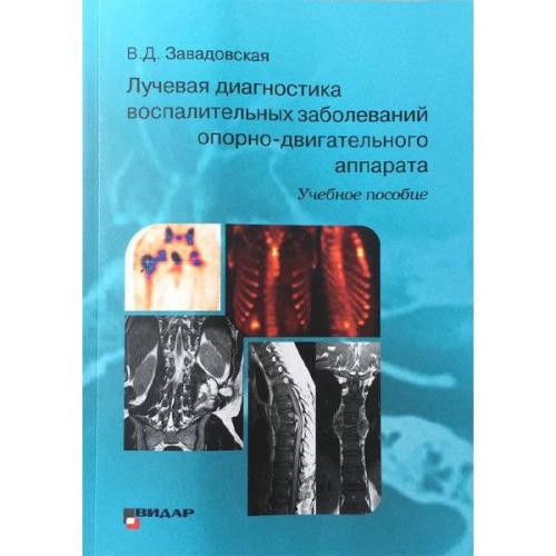 Туберкулезный спондилит (болезнь потта): диагностика, симптоматика и лечение