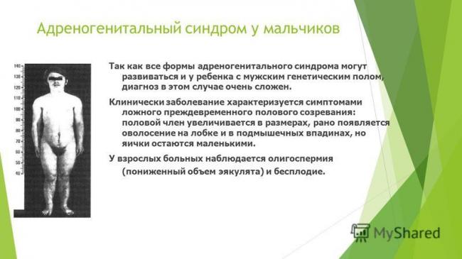 Адреногенитальный синдром - симптомы болезни, профилактика и лечение адреногенитального синдрома, причины заболевания и его диагностика на eurolab