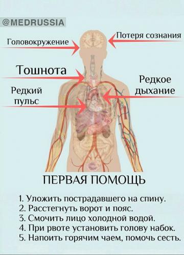 Обморок (синкопе): почему возникает, виды и провоцирующие факторы, как диагностировать и лечить