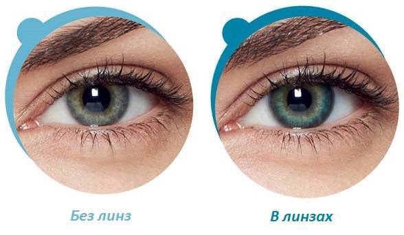 Acuvue oasys с технологией hydraclear plus
