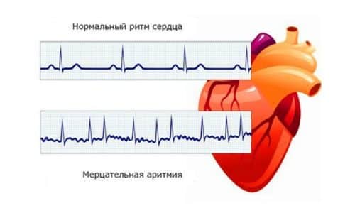 Дексаметазон (dexamethasone) инструкция по применению