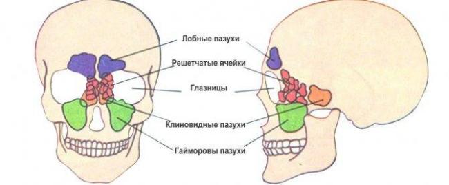 Хронический гиперпластический фронтит