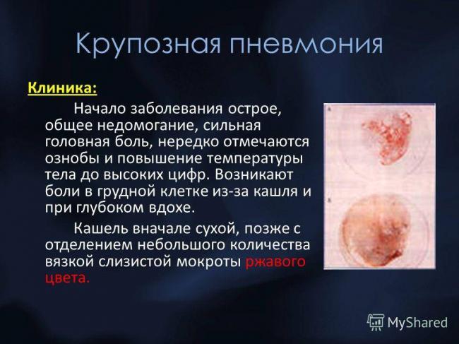 Пневмония — причины, симптомы и лечение пневмонии