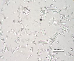 Диагностика протеинурии (памятка для врача)
