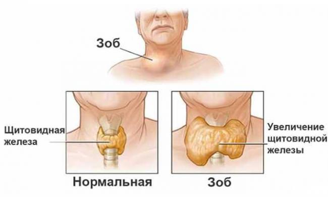 Калия йодид (potassium iodide)