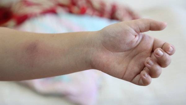 Манту мочить можно: зачем нас пугали в детстве и почему этот запрет не имеет смысла